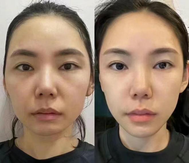 PG平台抗衰老产品哪个好？熬夜翻盘全靠它(图2)