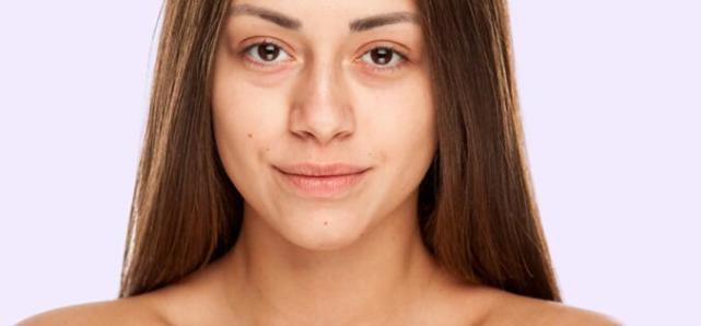 PG电子网站一到秋冬肌肤就有“小情绪”？不妨试试它(图3)