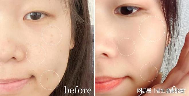 PG电子网站国家唯一认证的祛斑产品做美白丽人！(图4)