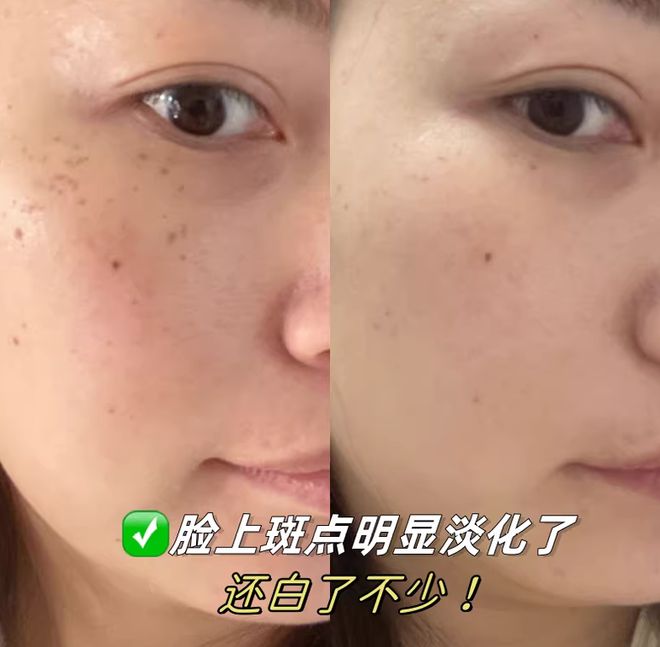 PG电子网站面膜哪个牌子效果好？好用的面膜推荐谁能拒绝的了？(图4)