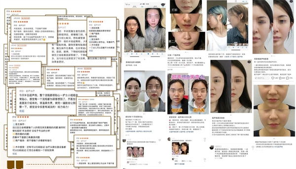 PG平台2024轻医美趋势解读：抗衰紧致需要高半岛超声炮最受资深用户喜爱(图5)