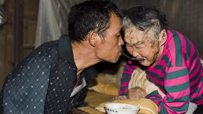 PG电子平台57岁母亲痴呆儿子辞职照顾洗澡睡觉都在一起：我不怕被人议论(图22)