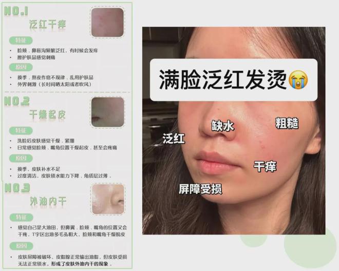 PG平台这罐能让掉“渣”糙干皮变水嫩灯泡肌的东西但凡有女生不知道我…(图6)