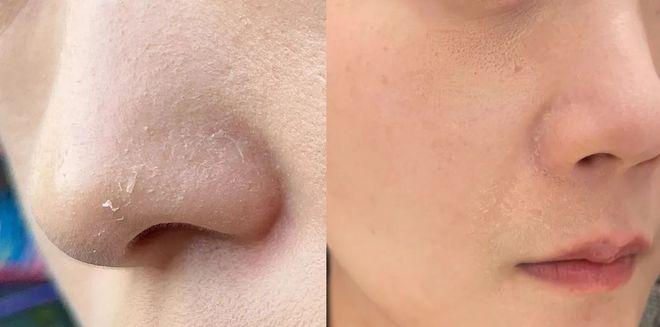 PG平台这罐能让掉“渣”糙干皮变水嫩灯泡肌的东西但凡有女生不知道我…(图3)