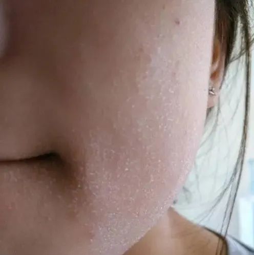 PG平台这罐能让掉“渣”糙干皮变水嫩灯泡肌的东西但凡有女生不知道我…(图2)