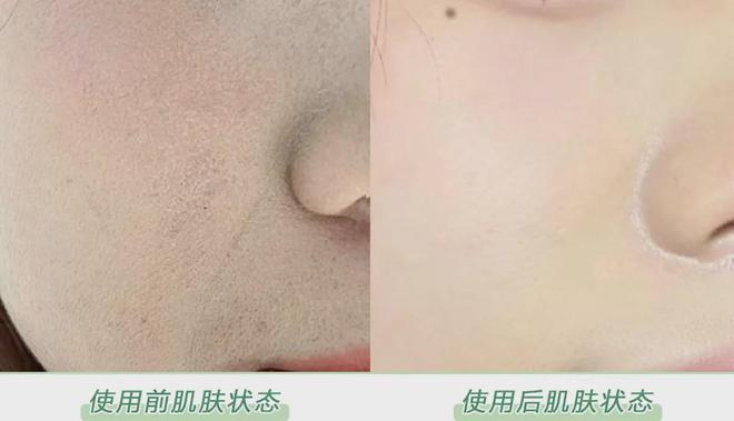 PG平台这罐能让掉“渣”糙干皮变水嫩灯泡肌的东西但凡有女生不知道我…(图14)