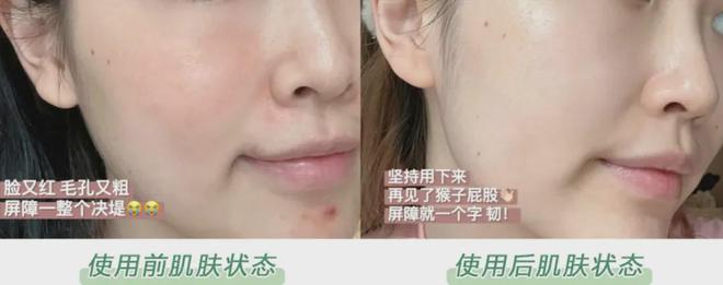 PG平台这罐能让掉“渣”糙干皮变水嫩灯泡肌的东西但凡有女生不知道我…(图31)