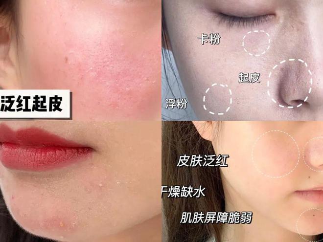 PG平台这罐能让掉“渣”糙干皮变水嫩灯泡肌的东西但凡有女生不知道我…(图26)