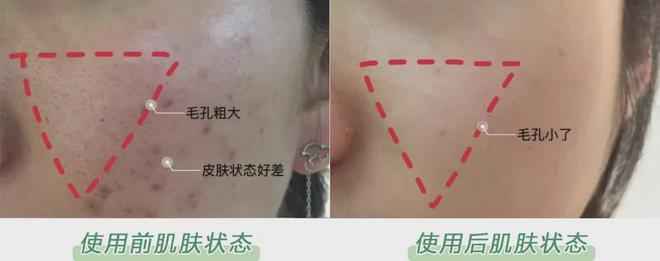 PG平台这罐能让掉“渣”糙干皮变水嫩灯泡肌的东西但凡有女生不知道我…(图21)