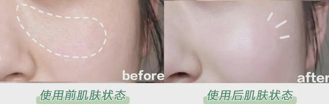 PG平台这罐能让掉“渣”糙干皮变水嫩灯泡肌的东西但凡有女生不知道我…(图23)