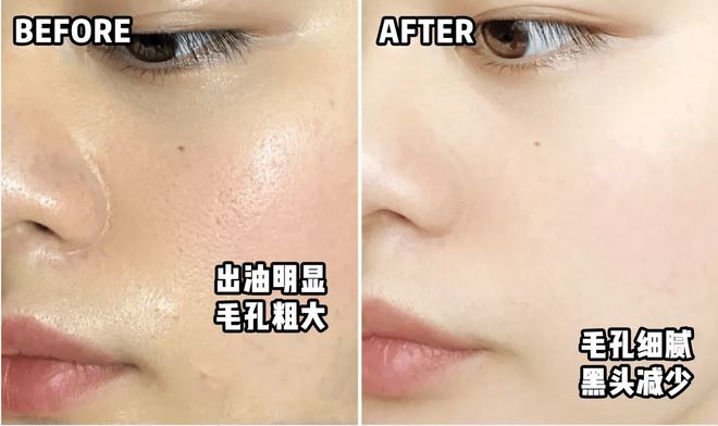 PG平台这罐能让掉“渣”糙干皮变水嫩灯泡肌的东西但凡有女生不知道我…(图22)