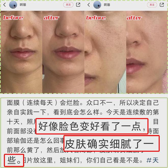 PG平台这罐能让掉“渣”糙干皮变水嫩灯泡肌的东西但凡有女生不知道我…(图32)