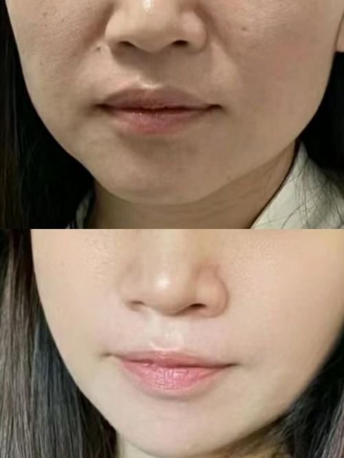 十大最有效抗衰老护肤品亲测：这几款真有效！(图4)