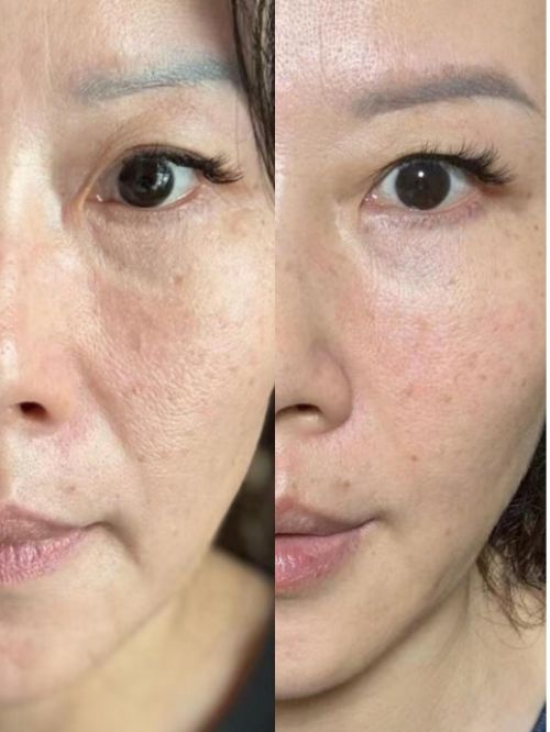 总结：紧致抗衰老的护肤品排行榜认准榜单不踩雷！(图4)