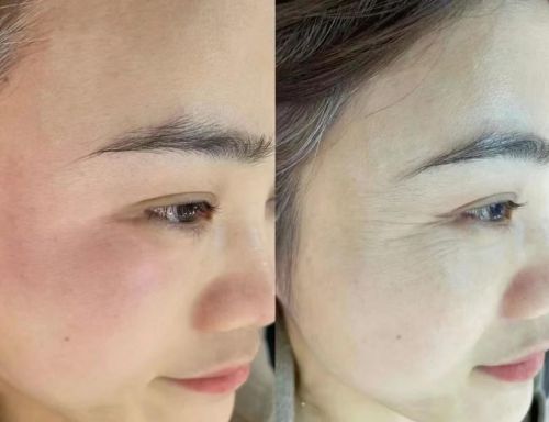 抗皱纹抗衰老哪个牌子好？分享：用户评价最高的几款产品(图4)