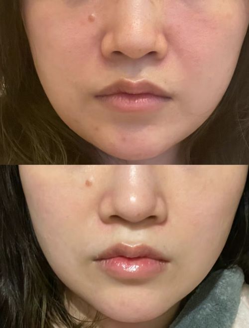 PG电子平台抗老抗衰护肤品哪个好用？亲测：这几款产品体验感很好。(图4)