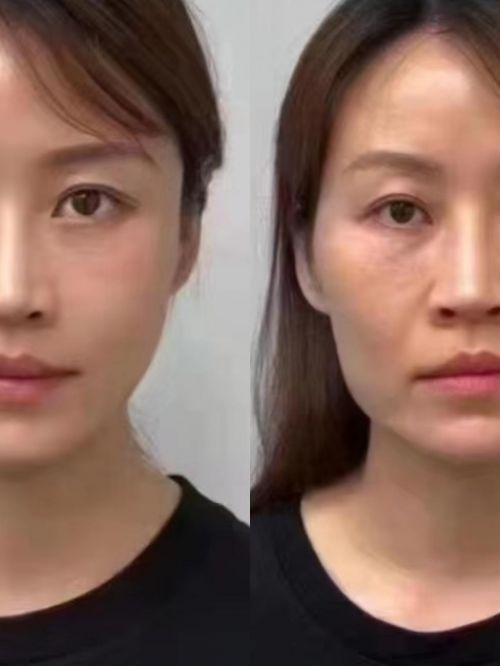 PG电子网站总结：十大最有效抗衰老护肤品这几款产品是专业人士的推荐！(图4)