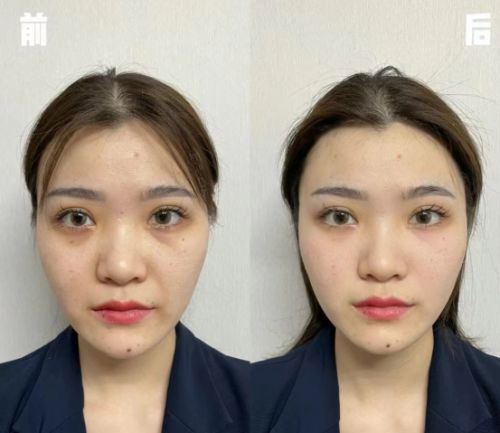 抗衰老护肤品有哪些品牌好抗皱产品合集来袭(图5)