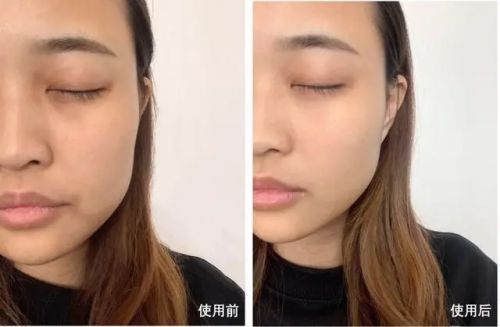 PG电子平台十大最有效抗衰老护肤品紧致抗皱就选择这款(图4)