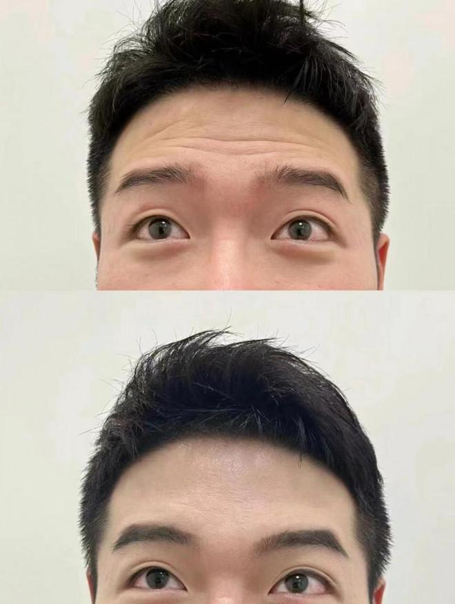 男士护肤品抗皱抗衰老超适合男士的护肤品合集(图5)