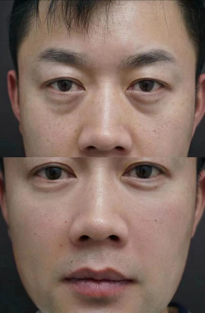 PG电子网站抗衰老产品排行榜前十强看看你的排在哪儿(图5)