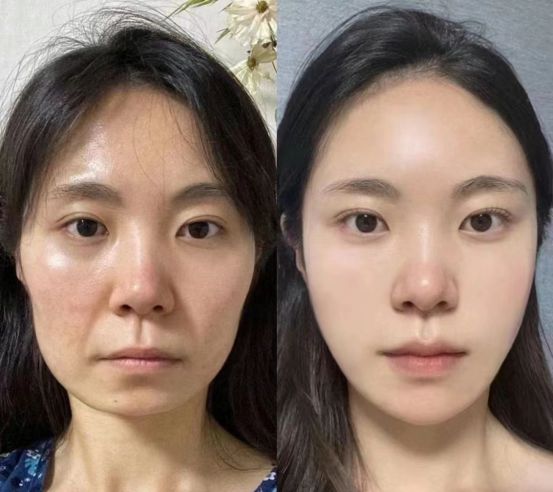PG电子网站抗衰老产品排行榜前十强看看你的排在哪儿(图4)