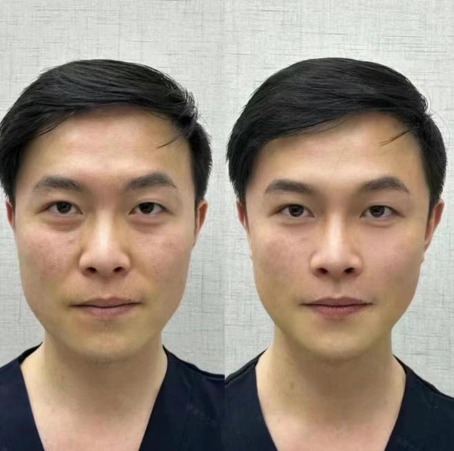 PG平台五十岁抗衰老最好的护肤品这几款值得入手(图4)