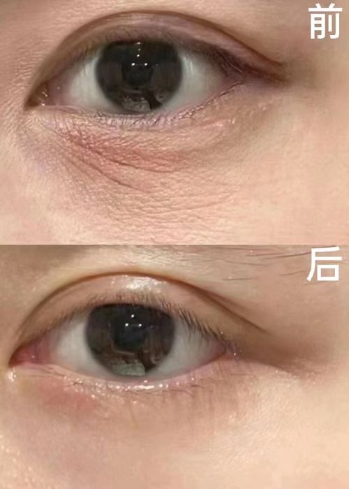 PG平台抗老抗衰护肤品合集抗衰老就从这三款产品开始！(图4)