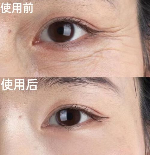 PG电子网站十大最有效抗衰老护肤品除了这几款产品真的没有其他的了!(图4)