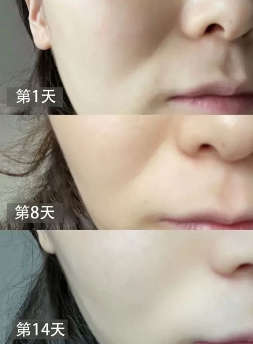 哪种护肤品抗皱好?2024抗衰老指南:护肤品只推荐这三款(图4)