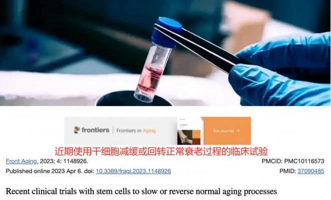全民120岁指日可待！日本科学家最新突破干细胞成抗衰最大黑马(图2)