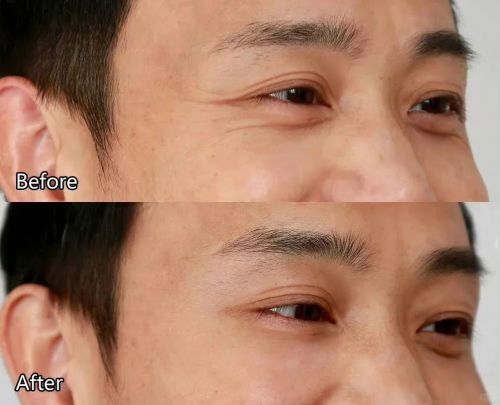 男士护肤品抗皱抗衰老！抗皱第一名国货：男士护肤品品牌排行！(图5)