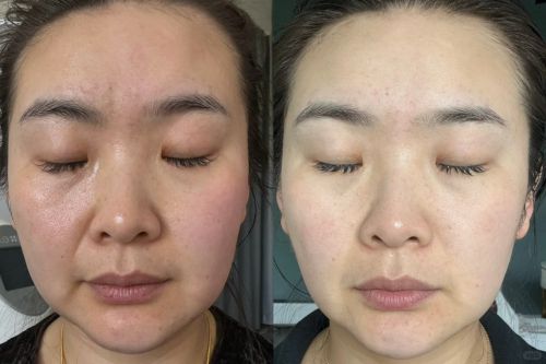 PG电子网站抗老抗衰护肤品排行榜！国货前三：这些平价抗衰品牌值得拥有(图5)