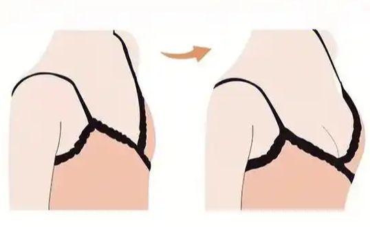 杭州美莱丰胸介绍-黄剑媚丰胸怎么样-杭州假体排行-变美分享(图2)