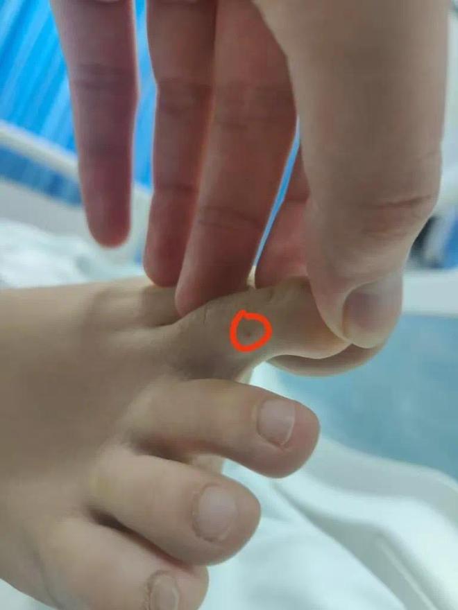 三亚女孩被蛇咬风波最近情况！蛇咬或被否定男友却被网友骂害人(图4)