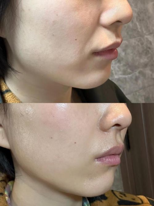 抗皱紧致护肤品十大国货祛皱抗皱最有效的护肤品清单分享(图5)