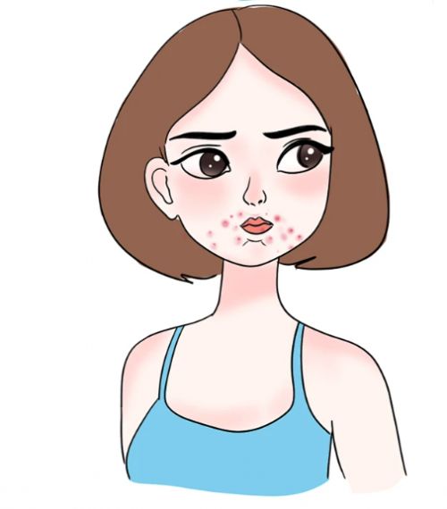 什么产品祛痘最好用？十大宝藏品牌推荐适合中学生祛痘的护肤品(图1)