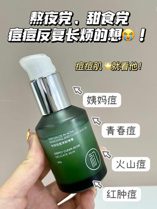 什么产品祛痘最好用？十大宝藏品牌推荐适合中学生祛痘的护肤品(图2)