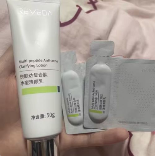 什么产品祛痘最好用？十大宝藏品牌推荐适合中学生祛痘的护肤品(图8)