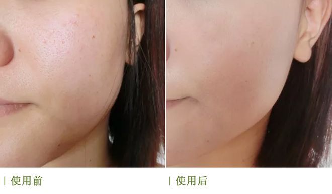 PG平台蹲到了！海之谜精粹水“大跳水”！补水保湿维稳一瓶搞定！(图18)