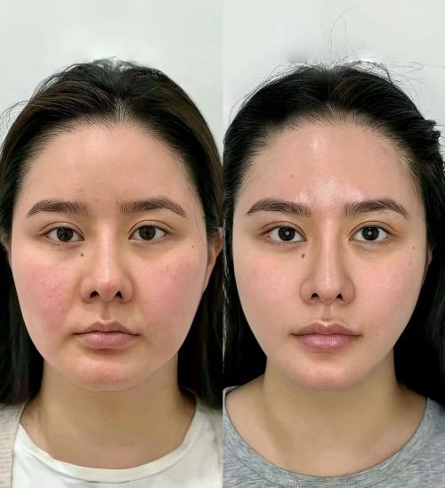 抗皱纹抗衰老的护肤品哪个牌子好？国货十大品牌放心选择(图3)