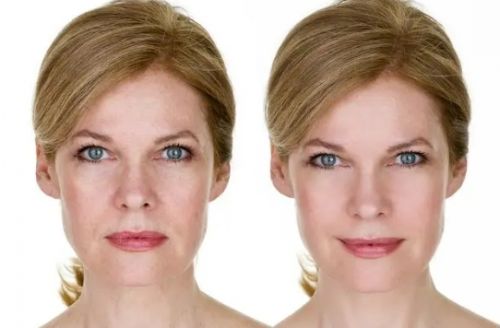 抗皱效果比较好的护肤品2024最佳抗老产品实力选手榜单(图1)