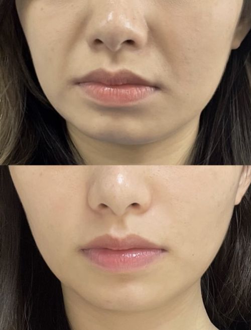 抗皱效果比较好的护肤品2024最佳抗老产品实力选手榜单(图4)