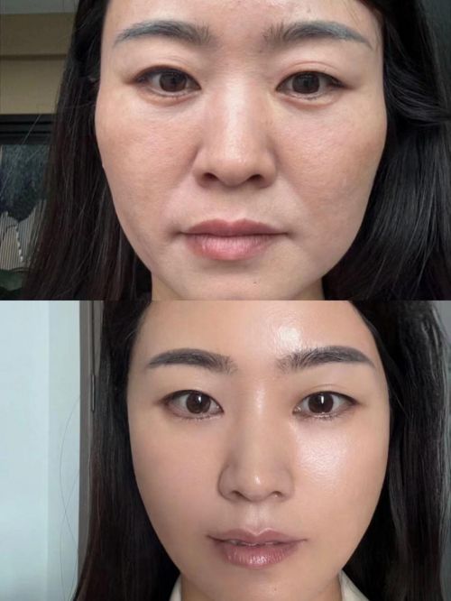 抗皱效果比较好的护肤品2024最佳抗老产品实力选手榜单(图5)