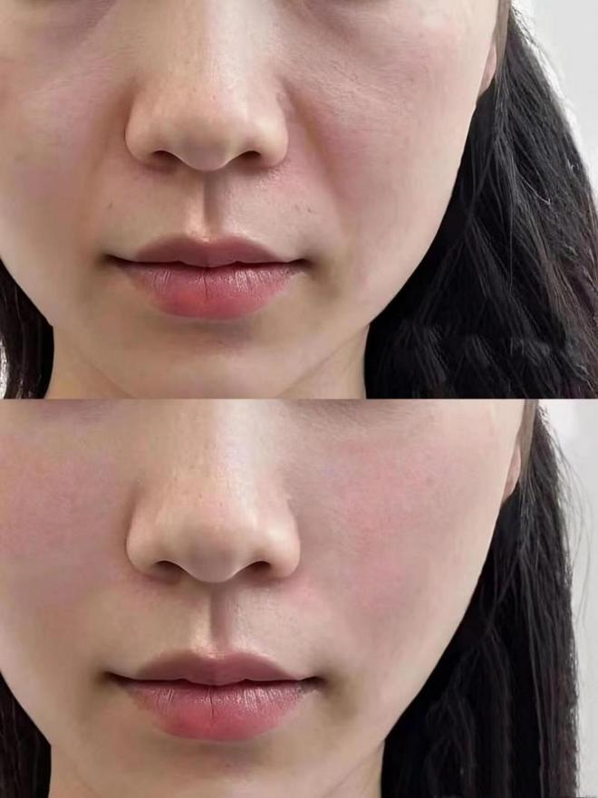 PG平台抗皱效果好的护肤品有哪些？分享抗皱好的名单2025年度口碑总结(图4)