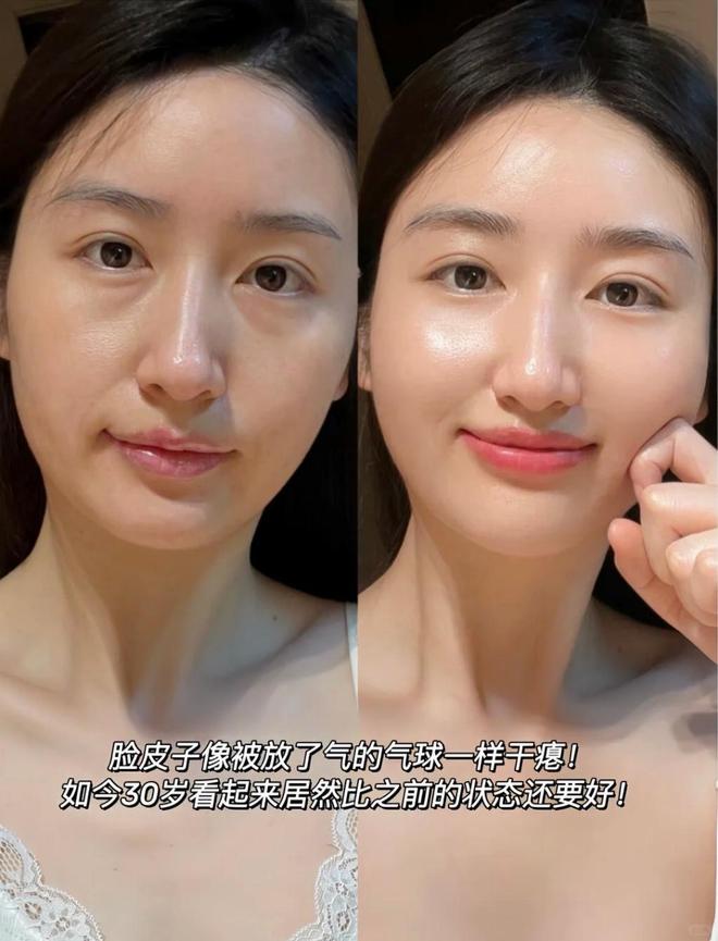 抗皱紧致护肤品十大分享抗皱紧致哪款好祛斑必参考清单(图3)