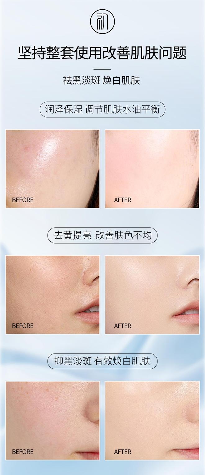 买什么淡斑产品最好效果快？祛斑攻略：十大高口碑祛斑美白护肤品(图5)