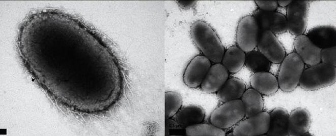 PG电子网站4周重启中年免疫力！Nature重磅：石榴中这一成分可延缓衰老(图4)