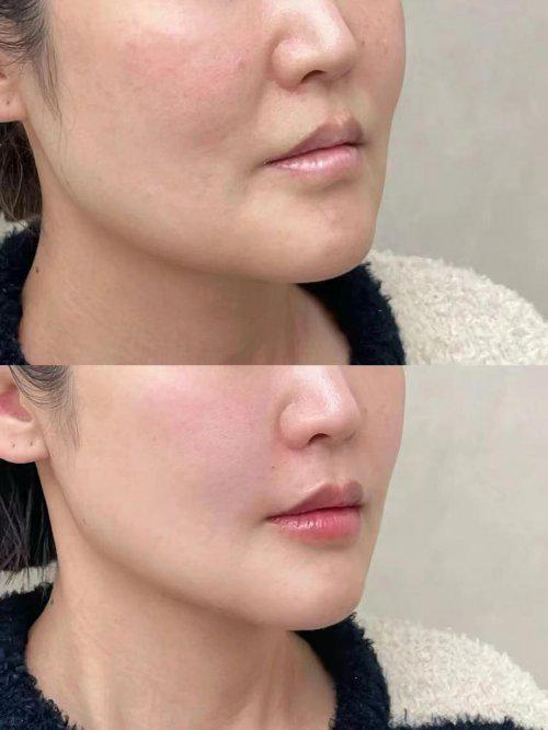 什么化妆品抗皱好？盘点抗皱紧致护肤十大紧致品牌种草(图6)