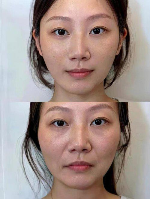 抗皱纹抗衰老的护肤品哪个牌子好？2025抗皱最好的护肤品分享(图5)